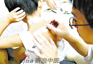 灸法的種類  你知道多少？